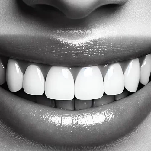 DALL·E 2024-07-08 23.55.04 - A close-up black and white image of a person's mouth smiling, showcasing perfectly aligned and healthy teeth. The focus should be on the teeth, with t